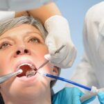 استفاده از رادیوسرجری در دندانپزشکی