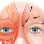 Dynamic Evaluation of Facial Muscles